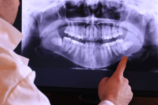 Best Chipped Tooth Repair Near Me  in Paradise, NV